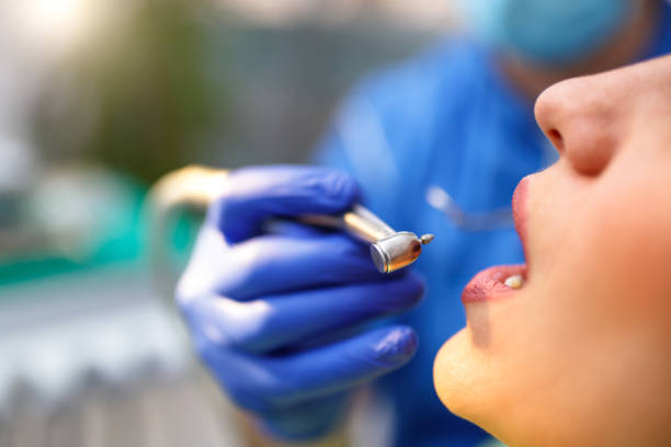Dental Inlays and Onlays in Waxhaw, NC